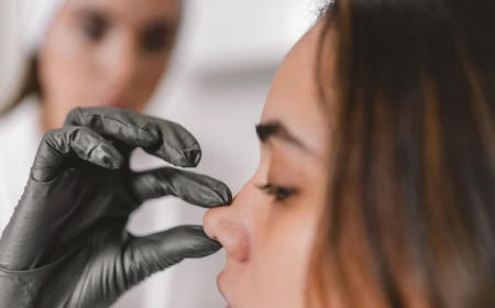 Open Rhinoplasty: Who Is It Suitable for and When Is It Preferred?